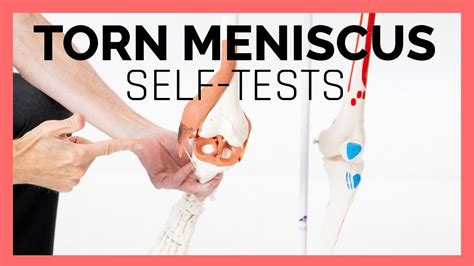 7 test for meniscus tear|what does a torn meniscus feel like.